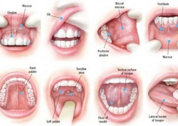 هفت درمان خانگی برای از بین بردن آفت دهان