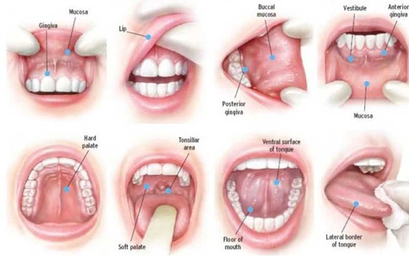 هفت درمان خانگی برای از بین بردن آفت دهان