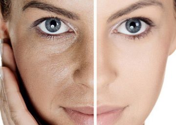 ۵ روش سریع برای درمان منافذ باز پوست صورت