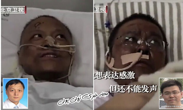 دو پزشک چینی پس از بهبودی کرونا سیاه پوست شدند