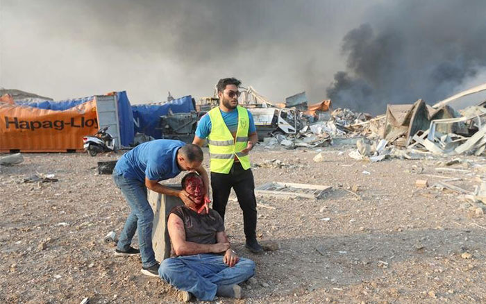 عکس زخمی ها و مصدومین بیروت